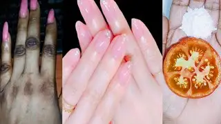 Hand whitening secret home remedies | Hand whitening cream | Manicure at home