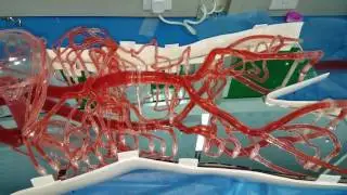 endo vascular simulation system from Trandomed 3D