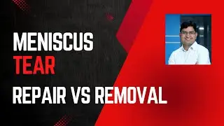 Can meniscus repair actually work? Here's why