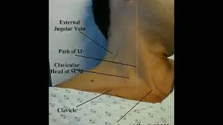 Side of neck spotting External juglar vein Clavicle #doctor #shortsfeed #short #shortsvideo