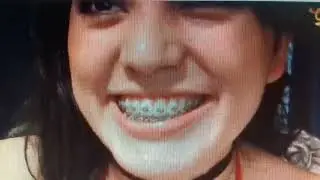 Teeth Fetish