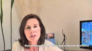 Nancy-Ultherapy-testimonial