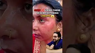 If you have used steroid creams on the face for a long time, here are things which can help #steroid