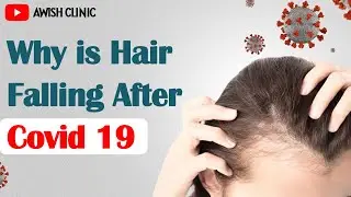 COVID के बाद बाल क्यों झड़ते हैं? इसका इलाज क्या हैं - Telogen Effluvium & Covid19 | AwishClinic.com