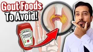 Избавьтесь от подагры с помощью этих продуктов | Продукты, которых следует избегать при подагре, ...