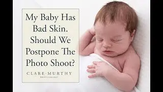 My Baby Has Spotty or Flaky Skin  Should We Postpone The Newborn Photo Shoot?
