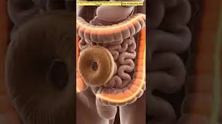 The Colon's Hidden Struggle: What Happens When Your Gut Is Blocked ? | Bio Anatomy Art | Gut Health
