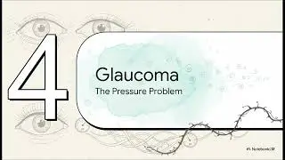 Macular Degeneration vs Cataracts vs Glaucoma | Vision Disorders Explained |