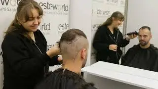 Hair Transplant Process of Our Guest from the Netherlands
