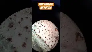 Kulit Udang di Microscop #science #udang #biotalaut #experiment #fyp #viralshorts