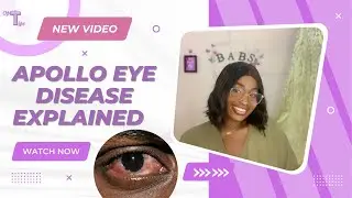 Apollo eye disease explained with prevention | optometry