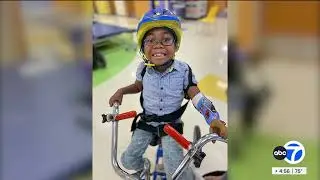 5-year-old taking on new life with prosthetic legs and arm after battling life-threatening illness