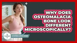 Why Does Osteomalacia Bone Look Different Microscopically? - Osteoporosis Support Network