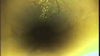 Allaccio fognatura non esguito correttamente