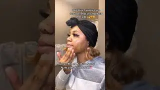 THE VIRAL TURMERIC FACE SCRUB THAT CHANGED MY LIFE 😍🧡