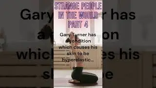Elastic Skin Phenomenon!😮🔴 Gary Turner's Condition #elastic #stretching #medicalcondition #body #odd