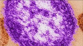 CDC finds 228 new cases of measles in 2019
