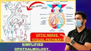 Optic Nerve | Visual Pathway | Anatomy & Clinical Ophthalmology | Medical Medics 