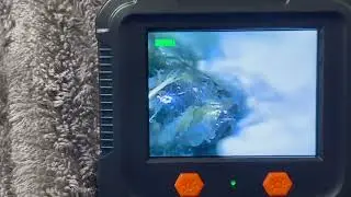 Daxiongmao Borescope, Endoscope Camera with Light, endoscope in use   kind of gross