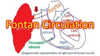 Fontan Circulation
