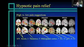 5  Hypnosis for Pain Management