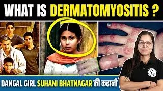 What is Dermatomyositis? | Dangal Girl Suhani Bhatnagar की कहानी