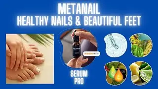 METANAIL-HEALTHY NAILS AND BEAULTIFUL FEET
