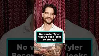 No wonder Tyler Posey&rsquo;s neck looks so strange.#tylerposey #teenwolf #usa #foryou #celebrity