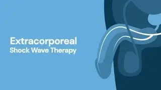 Extracorporeal Shock Wave Therapy (ESWT) for Erectile Dysfunction