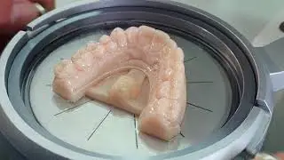 CC Trim - automate the precision trimming of occlusal appliances