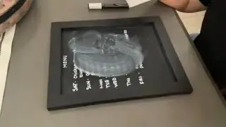 Chalkboard Meal Prep ASMR A week of Dinner Ideas