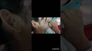 full face  threading