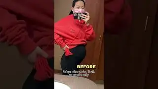 Belly Transformation After Giving Birth!