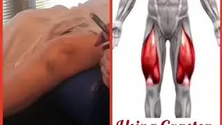 Using Graston Tools to Drop Knee Pain By 50%