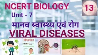 viral disease