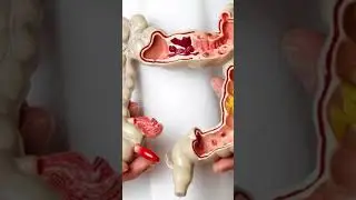 6 Common Gastrointestinal Health Problems You Must Know | Dr. Manish Gupta | Ghaziabad