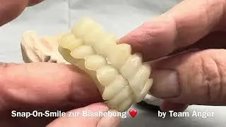 DENTALLIGENT PRAXIS by Michael Anger - Snap on Smile Bisshebung