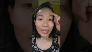 All you need to reduce forehead lines and wrinkles #facialexercise #faceworkout #faceyogamethod