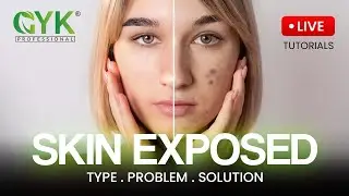 Skin Types: Problems, Solutions & Live Demo! GYK Professional