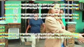 6 taong gulang na bata, nakitaan ng mga pasa, black eye at bukol | Resibo
