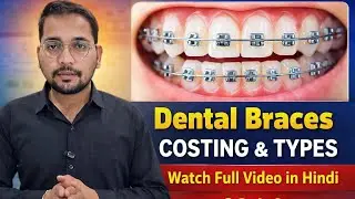 “Dental braces ka kharcha kitna hota hai?” Braces Kitne Type Ke Hote ? Dekhe Pura Video ||