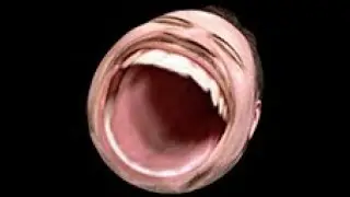 OMEGALUL