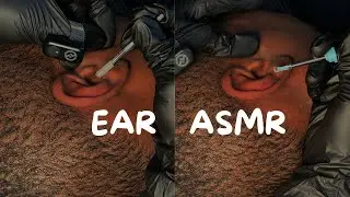 ASMR | Ear Cleaning and Ear Wax Removal | No Talking | Gentle Sounds