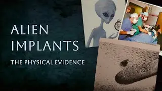 Alien Implants: The Physical Evidence