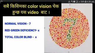 Check your color vision before EPS Exam