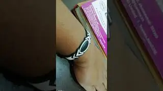 NOProblem Ion Balance Bracelet #painReduction #improvedsleep #ytshorts #shorts
