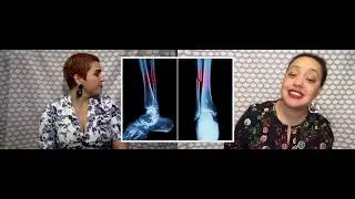 Materials & Methods: What's In A Skeleton V - Bone Break