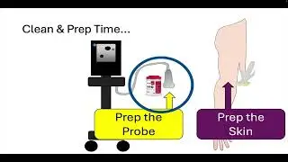 How to Set Up for an Ultrasound Guided Peripheral IV