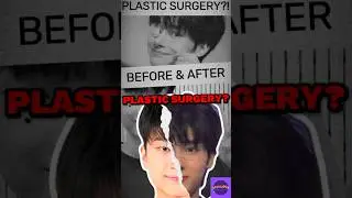 Lee Yedam Glow-Up Journey: Did He Get Plastic Surgery? #leeyedam #kpop #kpopnews #onepact #kpopidol