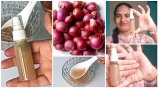 ಈರುಳ್ಳಿ Hair spray, ಸಣ್ಣ ಈರುಳ್ಳಿಯಿಂದ ಹೀಗೆ ಮಾಡಿ ಕೂದಲು ಬೇಡ ಅಂದ್ರು ಬೆಳೆಯುತ್ತೆ. Dandruff ಜನ್ಮದಲ್ಲಿ ಬರಲ್ಲ